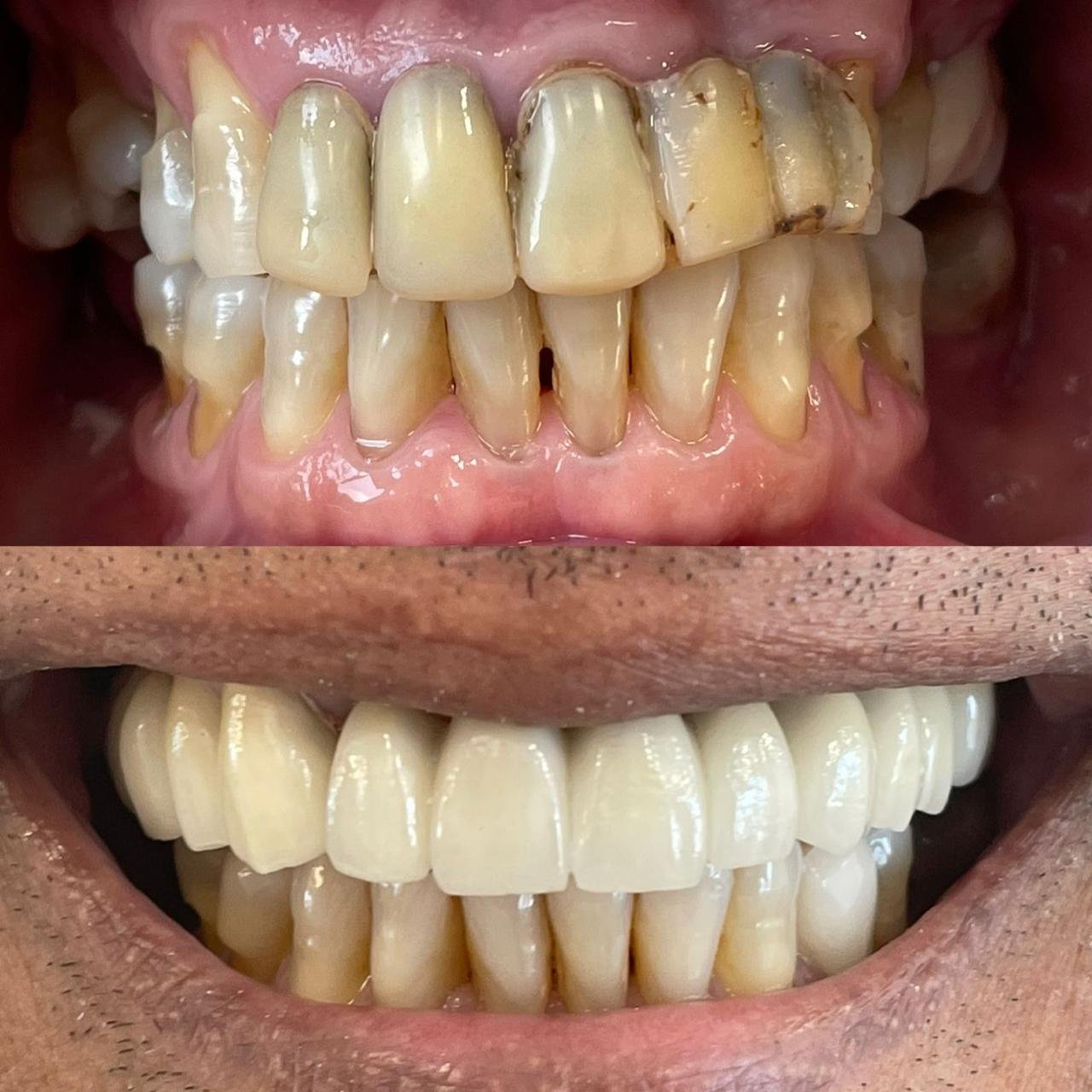 Protocolo Dentário