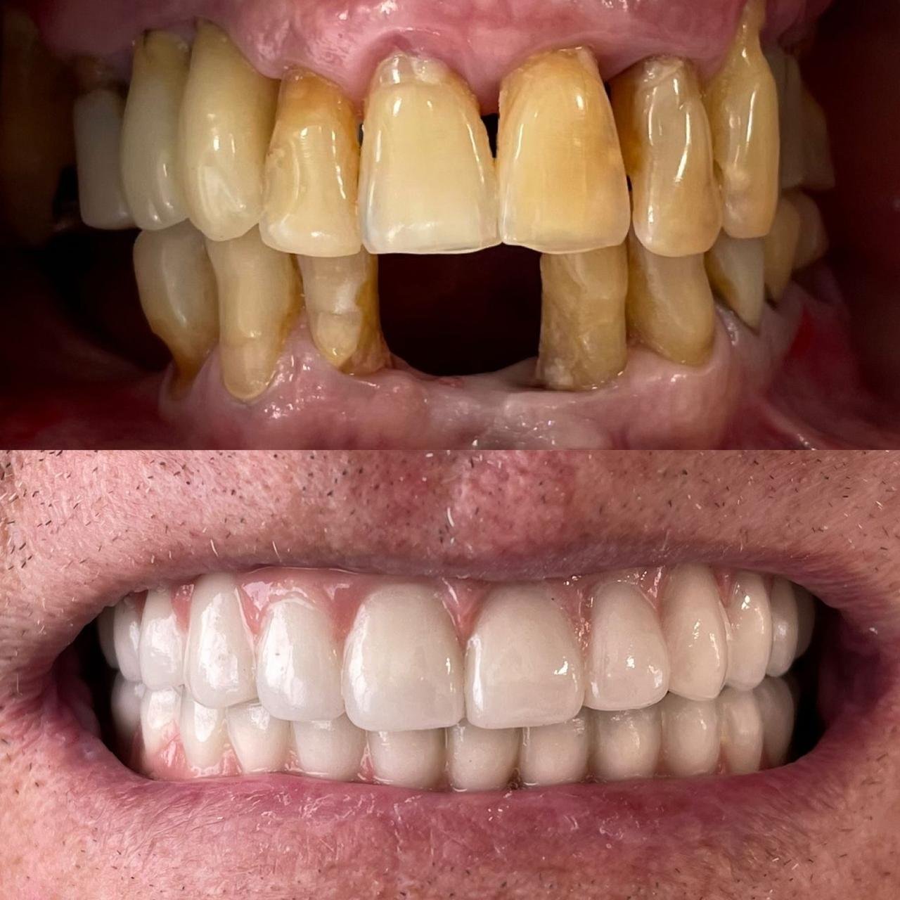Protocolo dentário